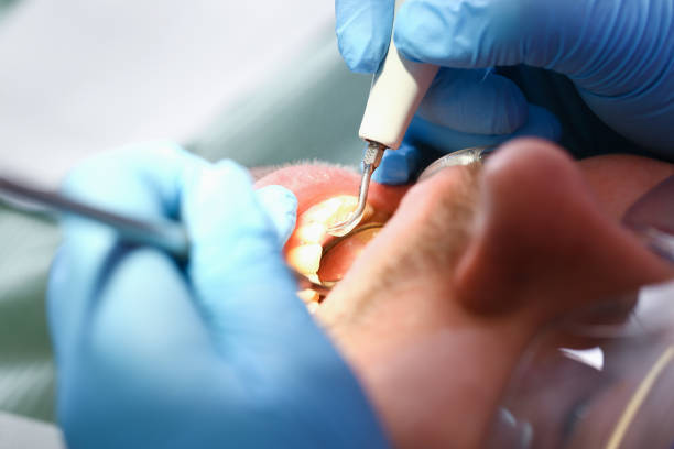 Best Emergency Dentist Open Today  in Balfour, NC